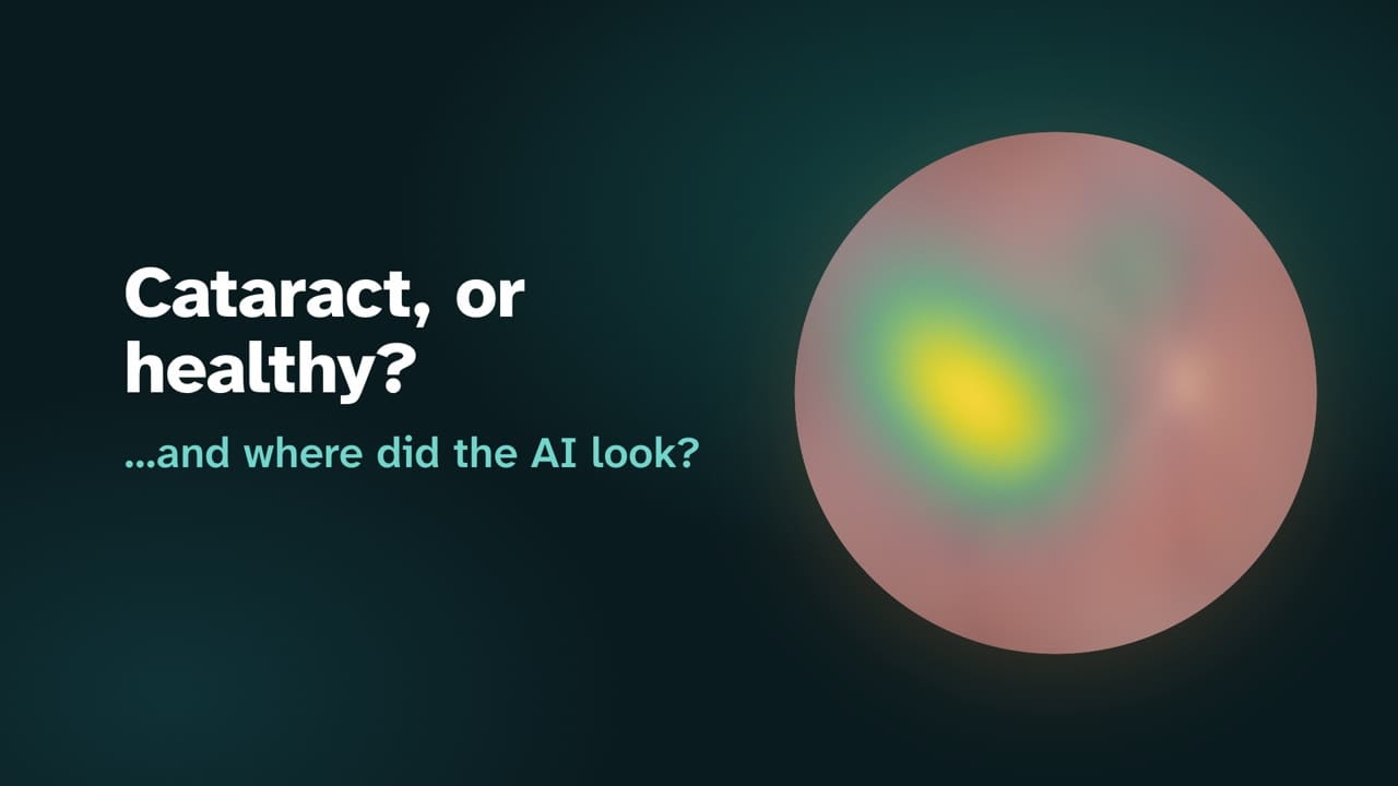 Cataract Detection AI System, CNN-based medical imaging with GradCAM explainability achieving 97% accuracy, IEEE published research by Rutwik Patel